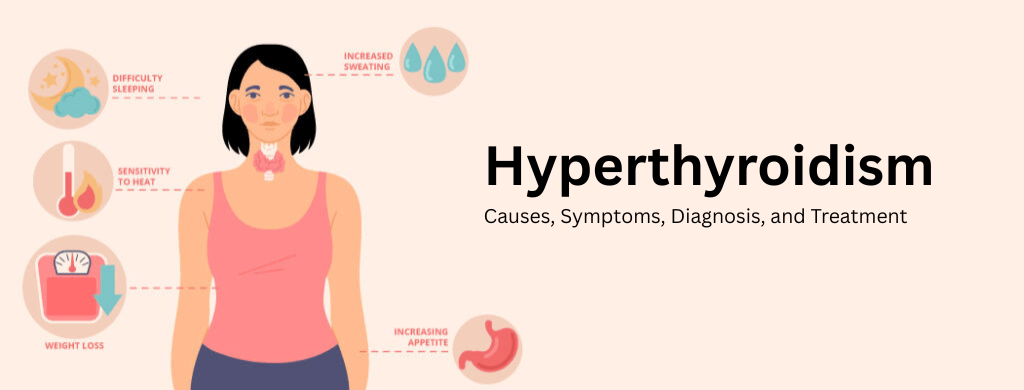 Hyperthyroidism: Causes, Symptoms, Diagnosis, and Treatment Hyperthyroidism: Causes, Symptoms, Diagnosis, and Treatment