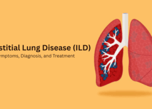 Interstitial Lung Disease (ILD): Types, Symptoms, Diagnosis, and Treatment