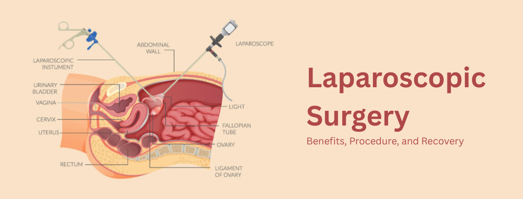 Laparoscopic Surgery: Benefits, Procedure, and Recovery