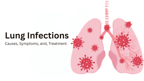 Lung Infections: Causes, Symptoms, and Treatment Lung Infections: Causes, Symptoms, and Treatment