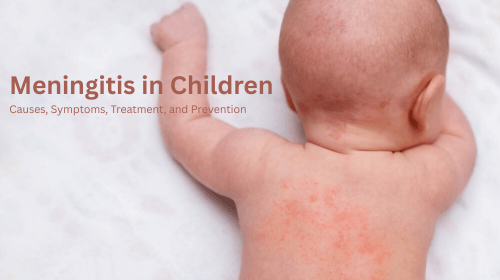 Meningitis in Children: Causes, Symptoms, Treatment, and Prevention Meningitis in Children: Causes, Symptoms, Treatment, and Prevention