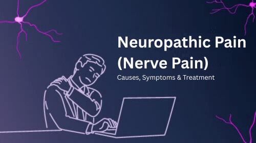 Neuropathic Pain (Nerve Pain): Causes, Symptoms & Treatment Neuropathic Pain (Nerve Pain): Causes, Symptoms & Treatment