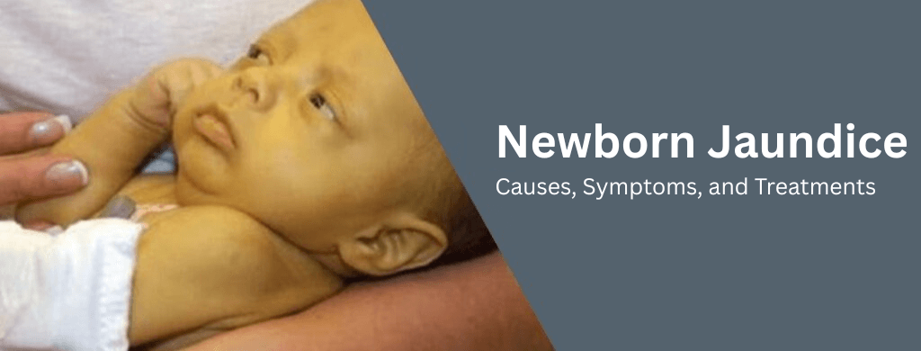 Newborn Jaundice: Causes, Symptoms, and Treatments Newborn Jaundice: Causes, Symptoms, and Treatments