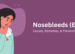Nosebleeds (Epistaxis): Causes, Remedies, & Prevention