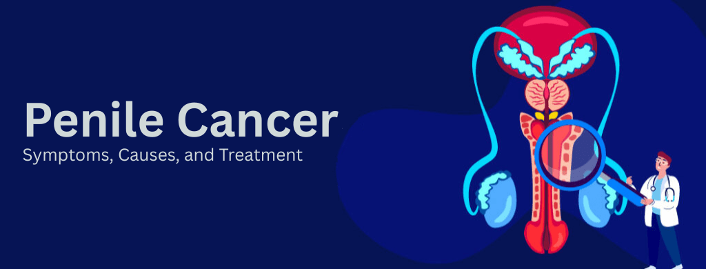 Penile Cancer: Symptoms, Causes, and Treatment Penile Cancer: Symptoms, Causes, and Treatment