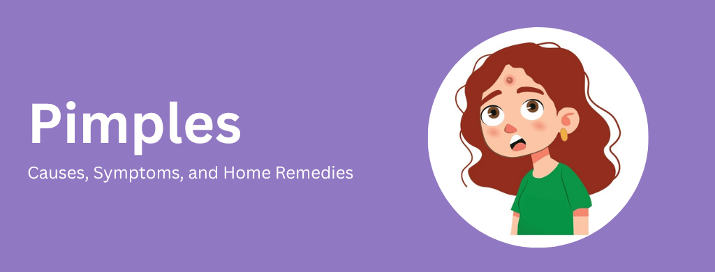 Pimples: Causes, Symptoms, and Home Remedies Pimples: Causes, Symptoms, and Home Remedies