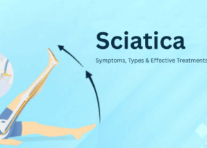 Sciatica: Symptoms, Types & Effective Treatments