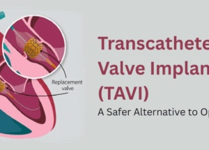 Transcatheter Aortic Valve Implantation (TAVI): A Safer Alternative to Open-Heart Surgery