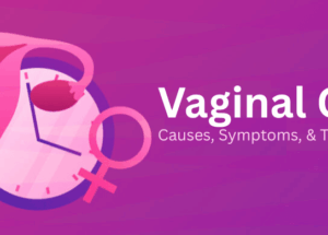 Vaginal Cancer: Causes, Symptoms, & Treatment