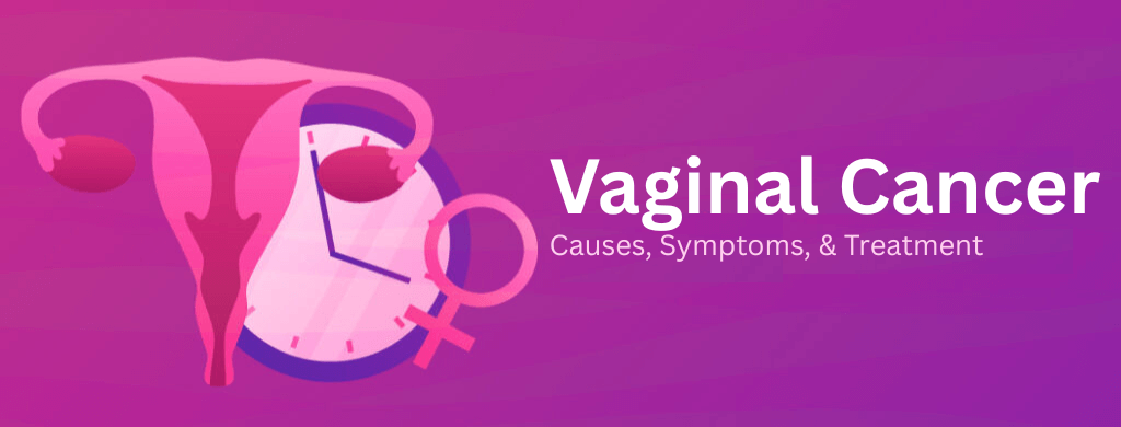 Vaginal Cancer: Causes, Symptoms, & Treatment