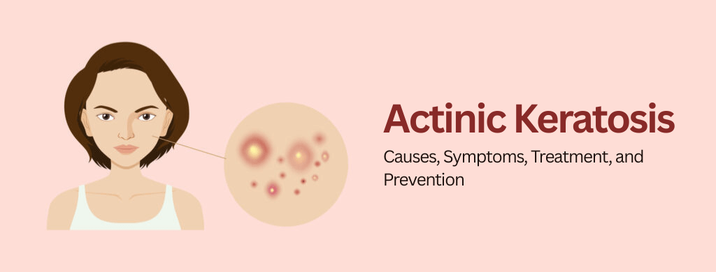 Actinic Keratosis: Causes, Symptoms, Treatment, and Prevention