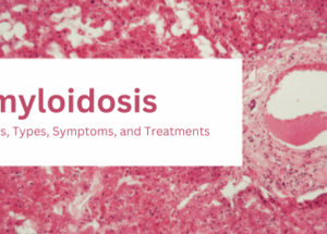 داء النشواني: الأسباب، الأنواع، الأعراض، والعلاجات