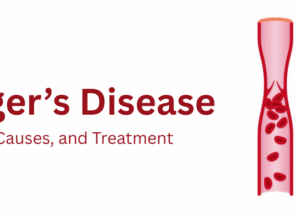 Buerger’s Disease: Symptoms, Causes, and Treatment