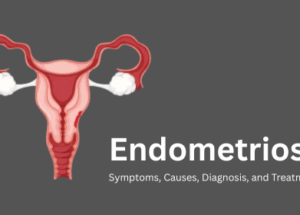 Endometriosis: Symptoms, Causes, Diagnosis, and Treatment