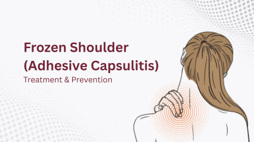 Frozen Shoulder (Adhesive Capsulitis): Treatment & Prevention