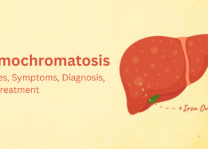 Hemochromatosis: Causes, Symptoms, Diagnosis, and Treatment