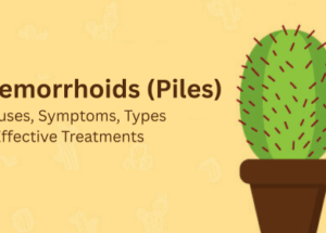 Hemorrhoids (Piles): Causes, Symptoms, Types & Effective Treatments