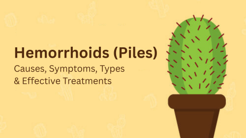 Hemorrhoids (Piles): Causes, Symptoms, Types & Effective Treatments