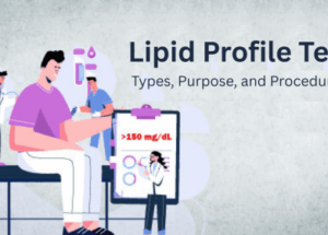 Lipid Profile Test: Types, Purpose, and Procedure