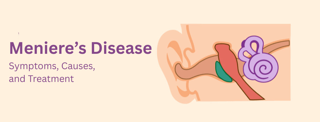 Meniere’s Disease: Symptoms, Causes, and Treatment