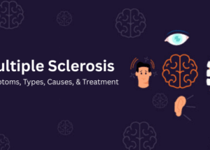 Multiple Sclerosis: Symptoms, Types, Causes, & Treatment