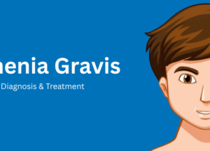 Myasthenia Gravis: Causes, Symptoms, Diagnosis & Treatment