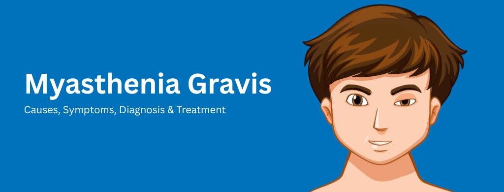 Myasthenia Gravis: Causes, Symptoms, Diagnosis & Treatment