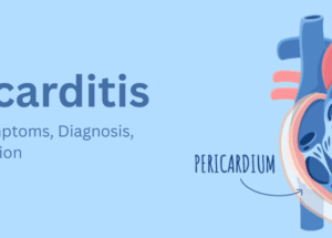 Pericarditis: Causes, Symptoms, Diagnosis, and Prevention