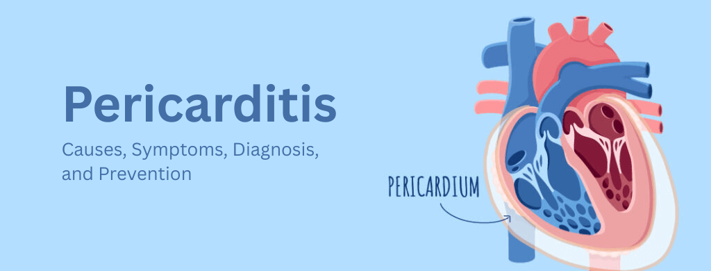 Pericarditis: Causes, Symptoms, Diagnosis, and Prevention