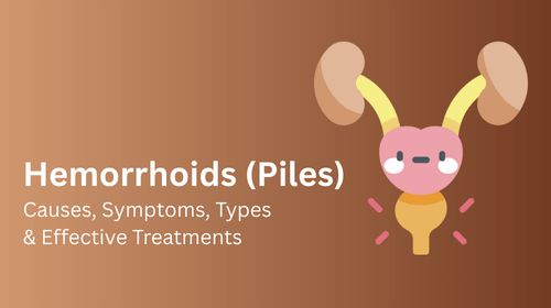 Prostate Cancer: Causes, Symptoms, Stages, and Treatment