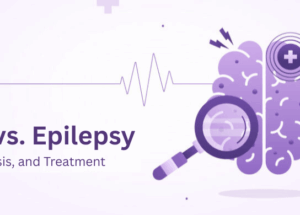 Seizures vs. Epilepsy: Symptoms, Diagnosis, and Treatment