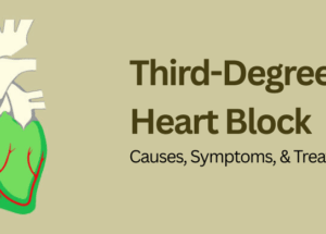 Third-Degree Heart Block: Causes, Symptoms, & Treatment Options