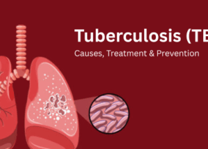 Tuberculosis (TB): Causes, Treatment & Prevention Explained