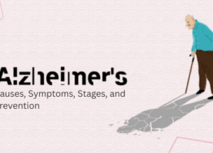 Alzheimer’s Disease: Causes, Symptoms, Stages, and Prevention