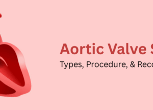 Aortic Valve Surgery: Types, Procedure, & Recovery: Types, Procedure, & Recovery