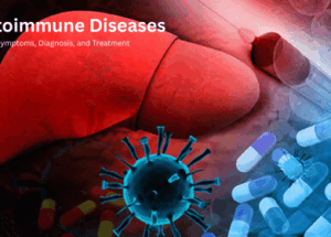 Autoimmune Diseases: Types, Symptoms, Diagnosis, and Treatment
