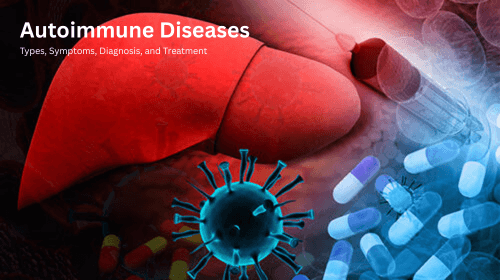 Autoimmune Diseases: Types, Symptoms, Diagnosis, and Treatment