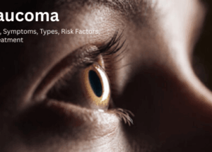 Glaucoma: Causes, Symptoms, Types, Risk Factors, and Treatment
