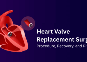 جراحة استبدال صمام القلب: الإجراء والتعافي والمخاطر