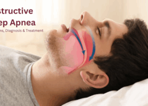 Obstructive Sleep Apnea: Symptoms, Diagnosis & Treatment