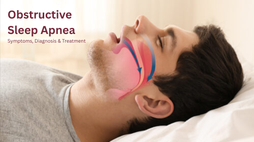 Obstructive Sleep Apnea: Symptoms, Diagnosis & Treatment
