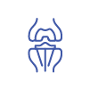 Arthroplasty (Joint Replacement)