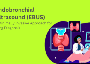 الموجات فوق الصوتية داخل القصبة الهوائية (EBUS): نهج أقل تدخلاً لتشخيص الرئة