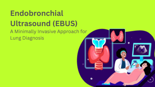Endobronchial Ultrasound (EBUS): A Minimally Invasive Approach for Lung Diagnosis