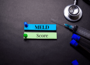 MELD Score for Liver Transplant: A Guide for Patients