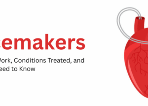 Pacemakers: How They Work, Conditions Treated, and What You Need to Know