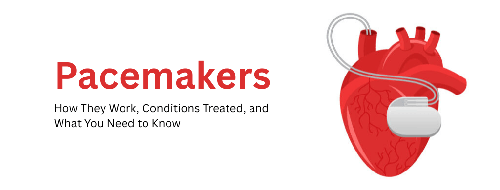 Pacemakers: How They Work, Conditions Treated, and What You Need to Know