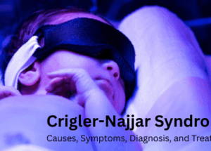 Crigler-Najjar Syndrome: Causes, Symptoms, Diagnosis, and Treatment