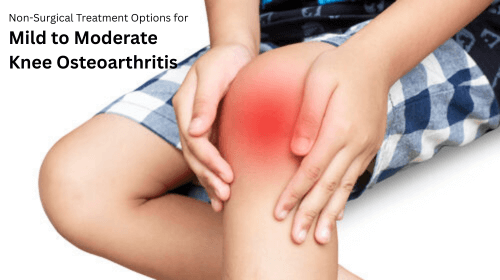 Non-Surgical Treatment Options for Mild to Moderate Knee Osteoarthritis