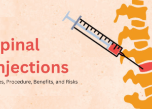 Spinal Injections: Types, Procedure, Benefits, and Risks